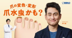 テレシー、佐藤製薬の爪水虫の疾患啓発を目的としたテレビCMの制作・放映を担当